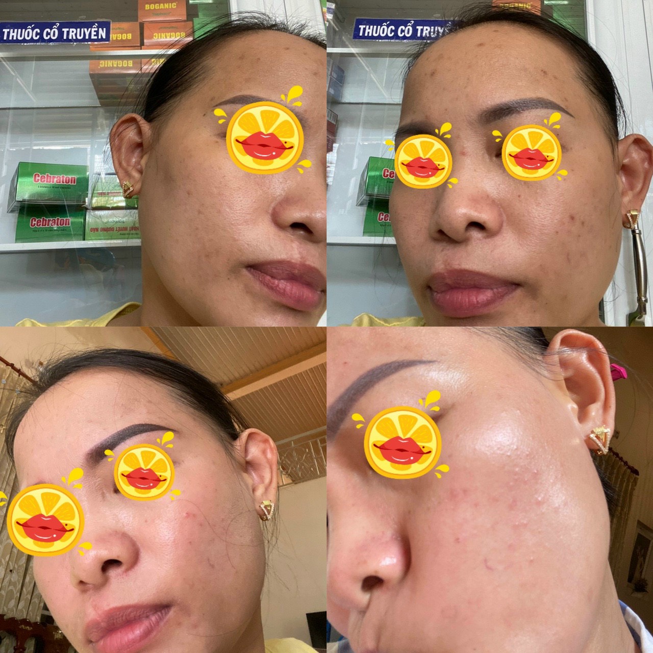 da trẻ hóa sau dùng kem age rescue innoaesthetics kết quả