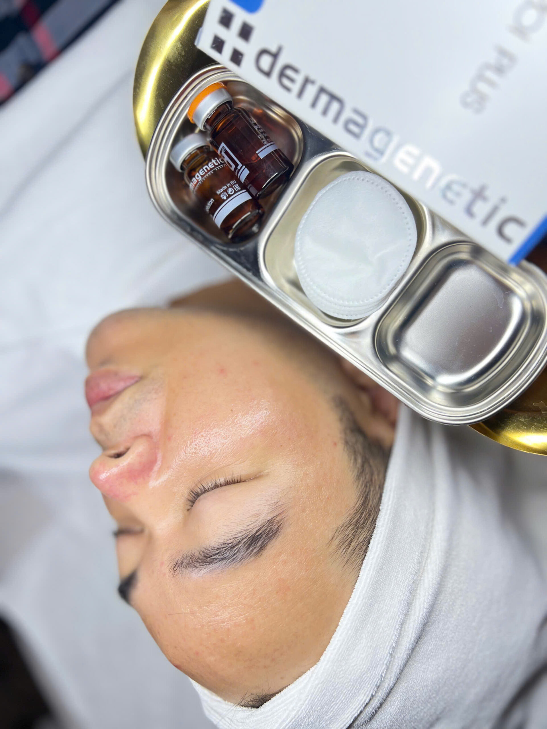 khách hàng sau liệu trình meso giakut căng bóng trắng sáng innoaesthetics