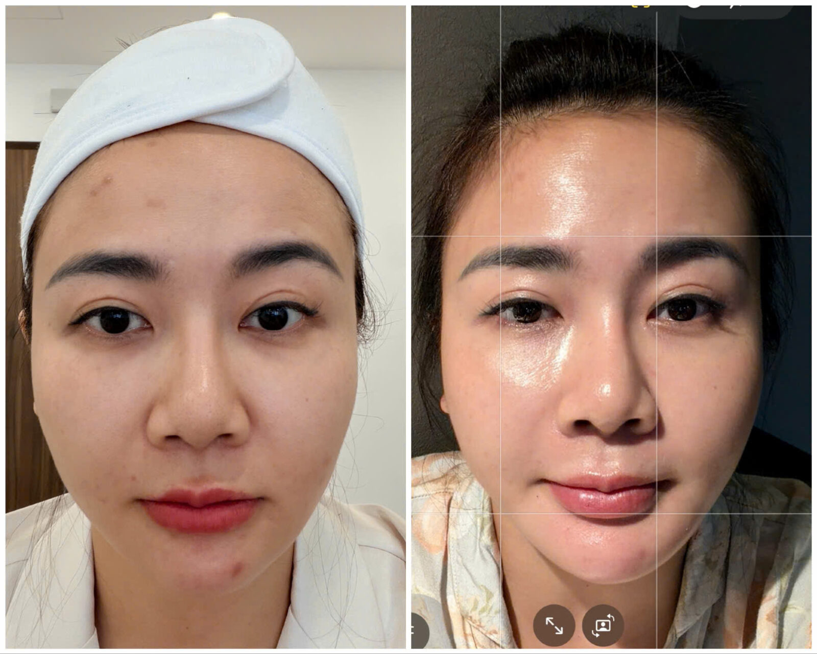 peel căng bóng sau 1 đêm với jessol peel gel
