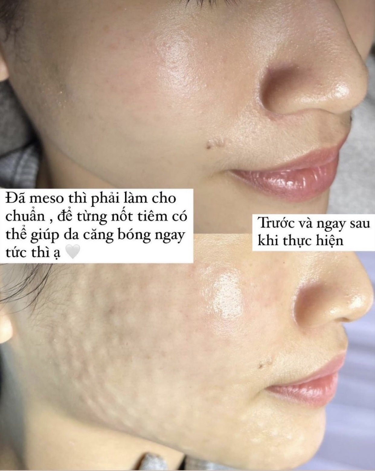 kết quả trắng sáng căng bóng da sau điều trị innoaesthetics