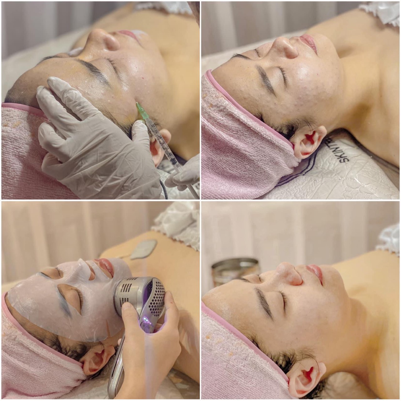 kết quả trắng sáng căng bóng da sau điều trị innoaesthetics