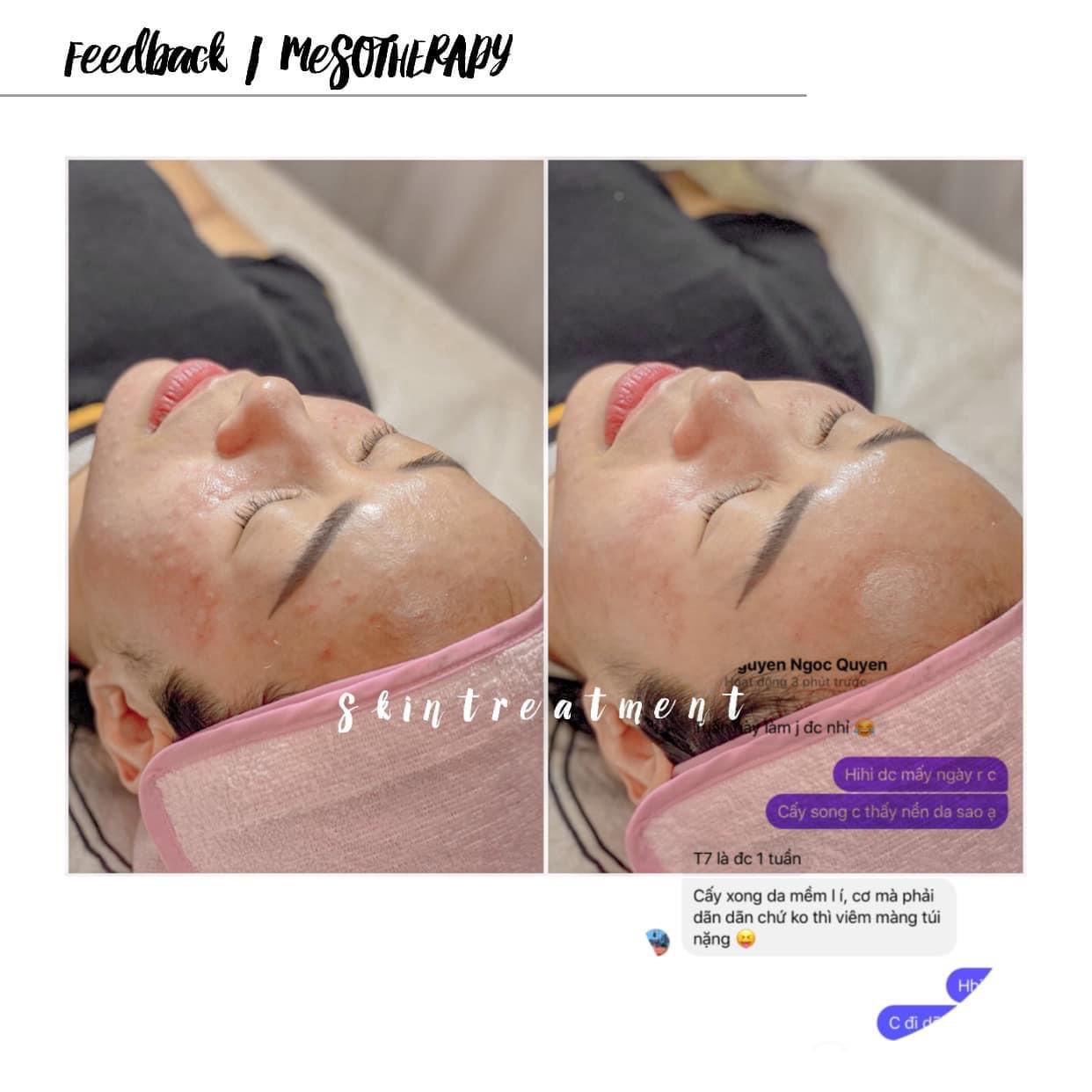 căng bóng trắng sáng da trước và sau điều trị innoaesthetics
