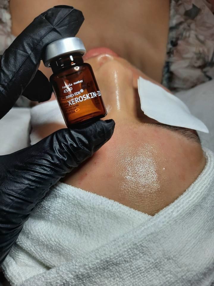 kết quả căng bóng trắng sáng sau meso xero skin id innoaesthetics