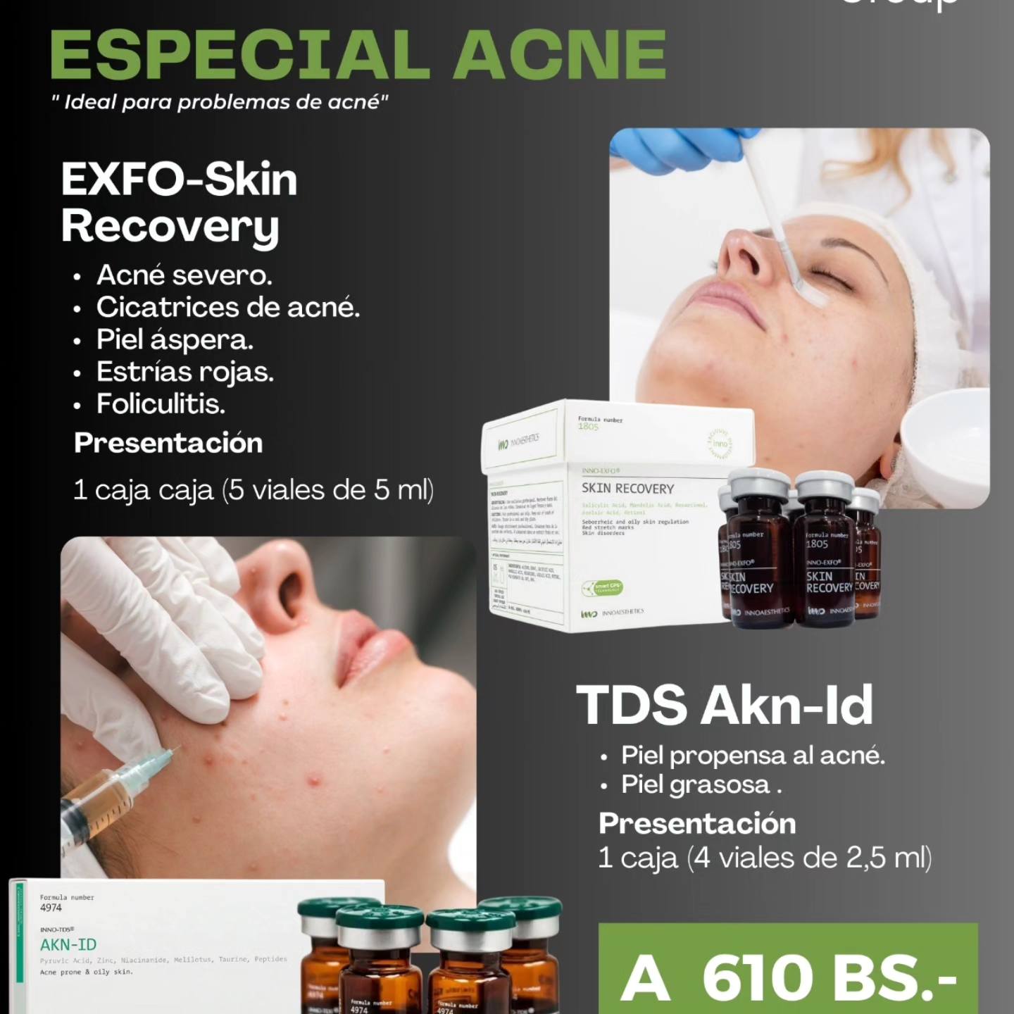 Phác đồ kết hợp Meso và Peel da điều trị mụn Innoaesthetics