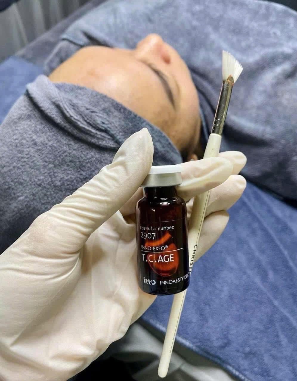 peel TCA 15% 20% sản phẩm trẻ hóa collagen innoaesthetics